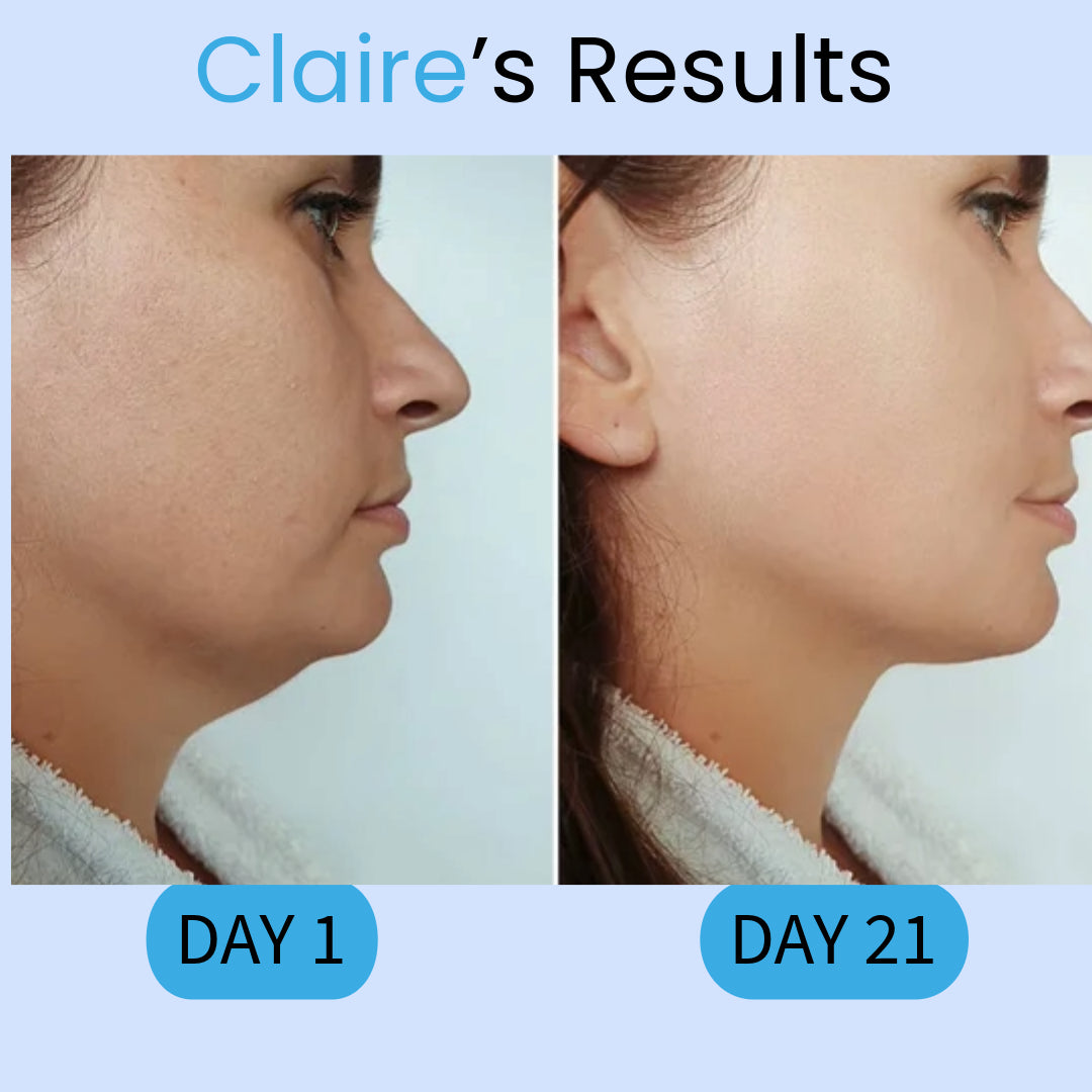 LivSkin™ Double Chin Mask